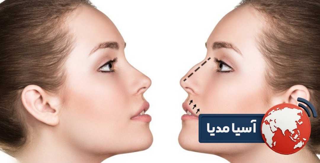 هزینه عمل بینی استخوانی