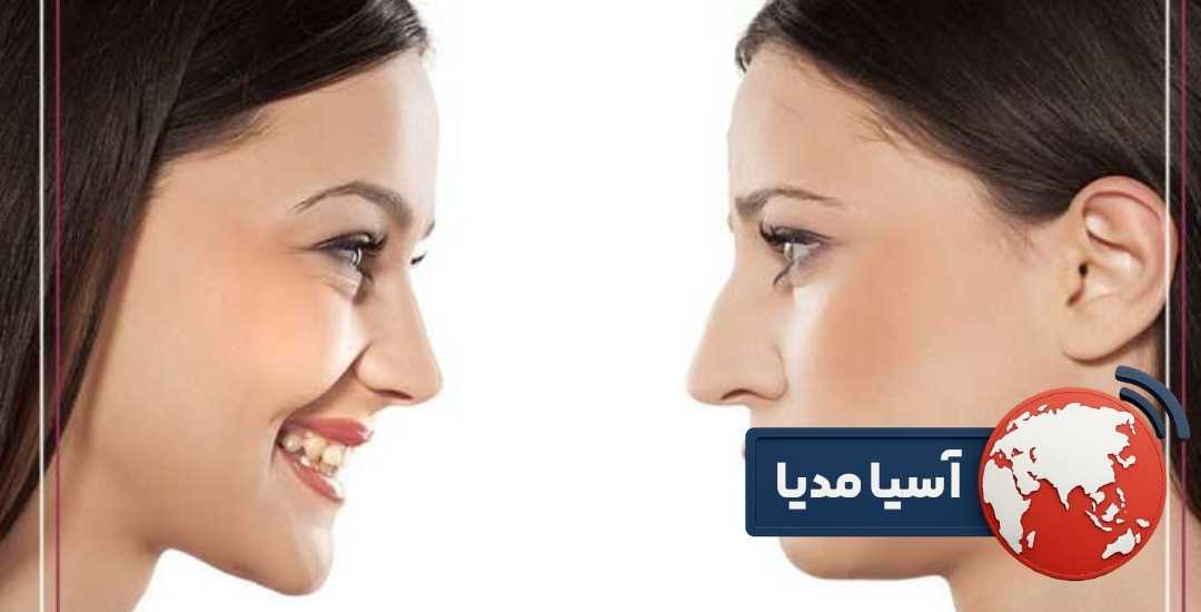 عمل جراحی مجدد زیبایی بینی رینوپلاستی