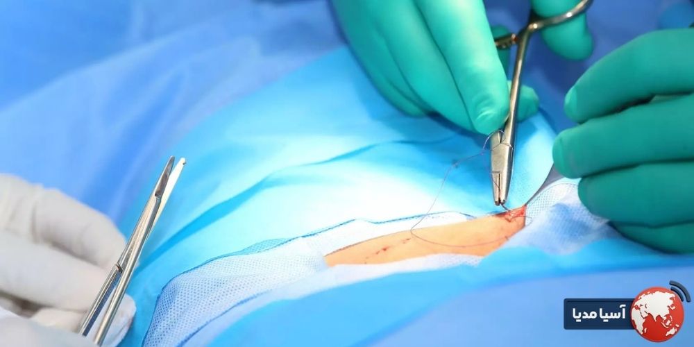 نکات تکمیلی مراقبت پس از جراحی