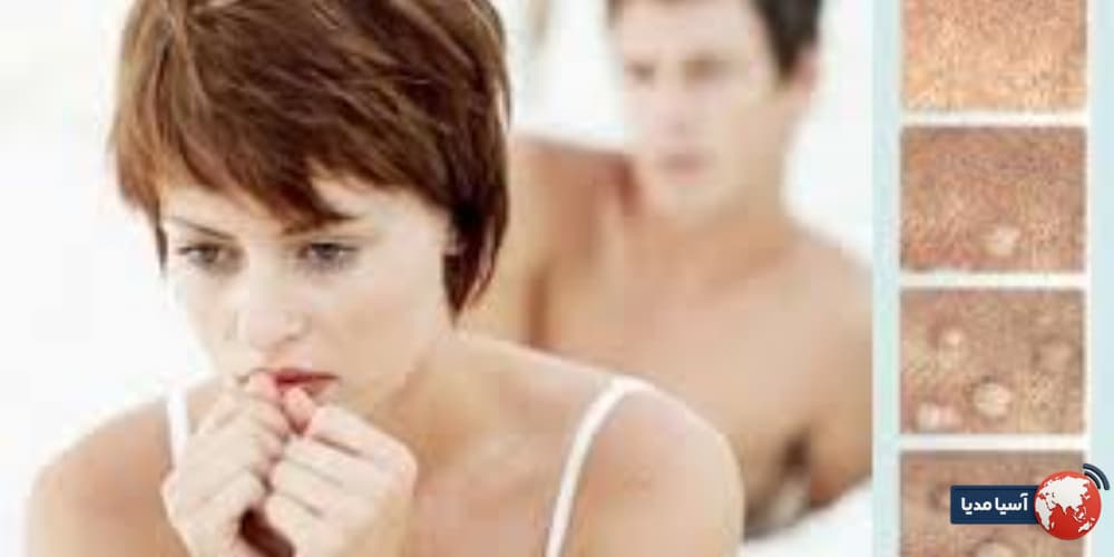 آیا بعد از لیزر زگیل تناسلی میتوان رابطه داشت و چه زمانی بی‌خطر است؟