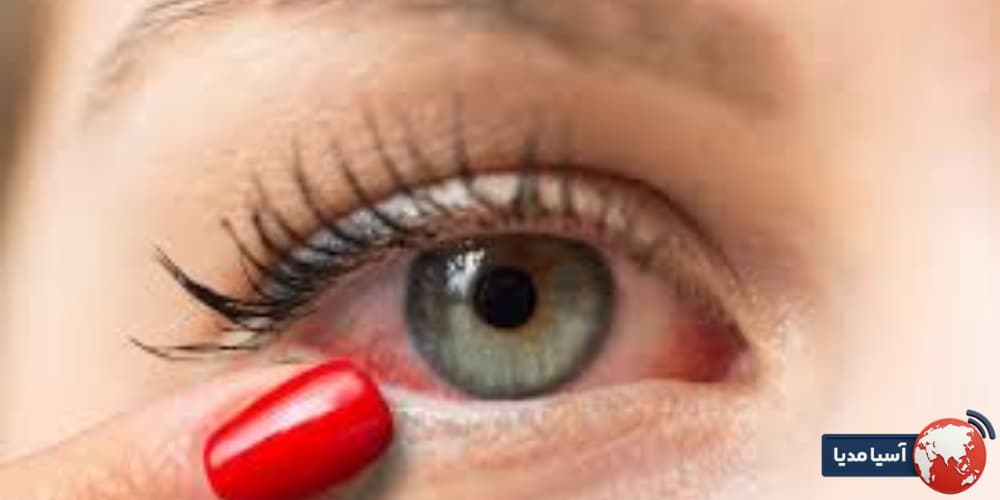 مقدمه: دلایل رایج سوزش هنگام استفاده از کرم دور چشم