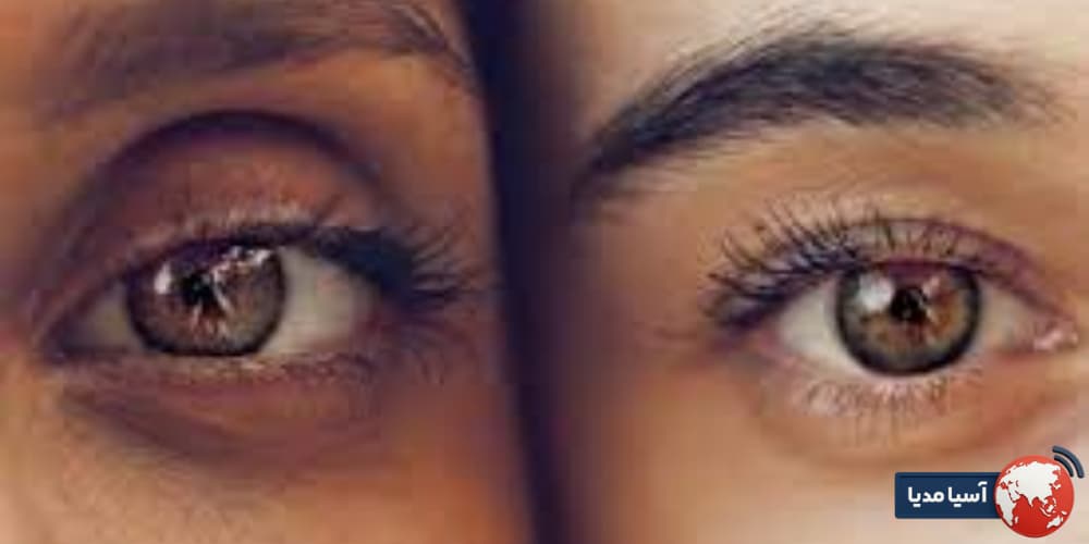 آیا استفاده از کرم دور چشم برای پوست‌های حساس مناسب است؟