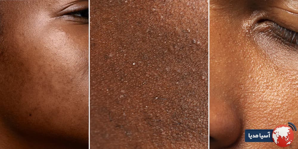 تأثیر ترکیبات کرم آبرسان بر رنگ پوست