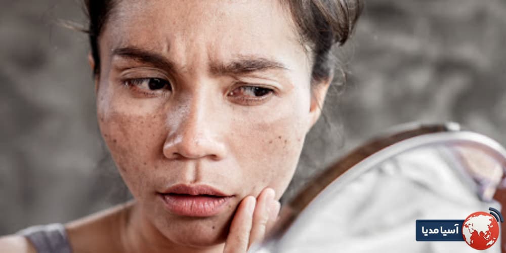آیا کرم آبرسان پوست را تیره میکند؟