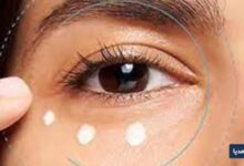 چرا کرم دور چشم باعث سوزش میشود؟