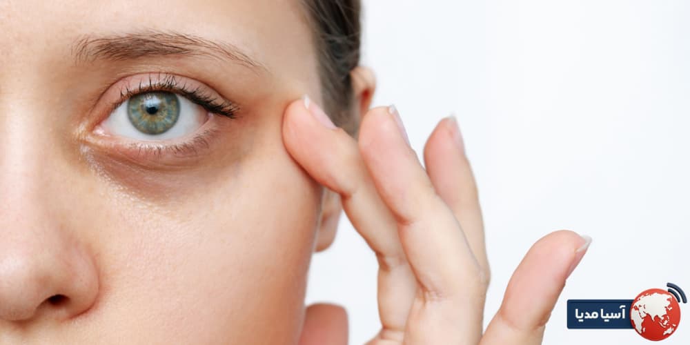 چگونه از سوزش کرم دور چشم جلوگیری کنیم؟